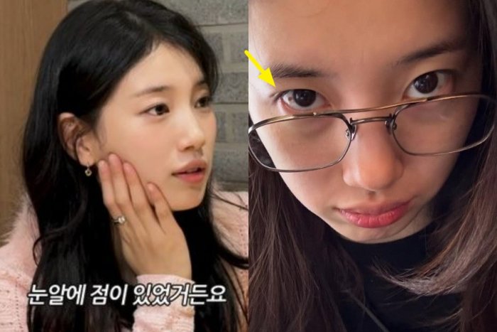수지, 눈 흰자 점 제거 고백 "은근히 마음에 들었는데.."