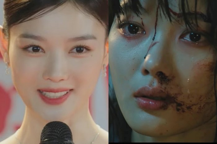 '친애하는X' 김유정, 소름 돋는 '두 얼굴' 예고한 파격 티저 (+영상)