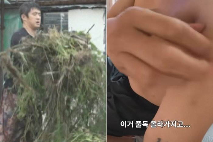 해프닝인 줄 알았는데…기안84가 참아온 '풀독'의 아픔